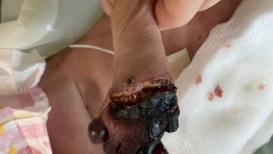 Photo of Greater Noida: गलत इंजेक्शन देने से नवजात का खराब होने की कगार पर पहुंचा हाथ, सपा ने दी आंदोलन की चेतावनी