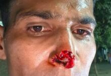 Photo of Noida: सियाचिन ग्लेशियर बेस कैंप में तैनात फौजी की ‘नाक काटी’, बाइक टकराने के बाद हुआ जमकर हुआ बवाल