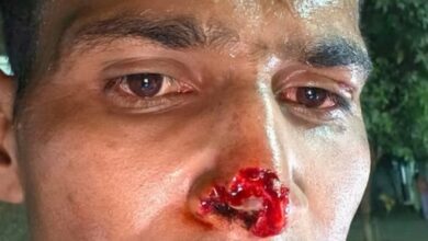 Photo of Noida: सियाचिन ग्लेशियर बेस कैंप में तैनात फौजी की ‘नाक काटी’, बाइक टकराने के बाद हुआ जमकर हुआ बवाल